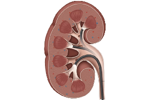Chronic Kidney Disease